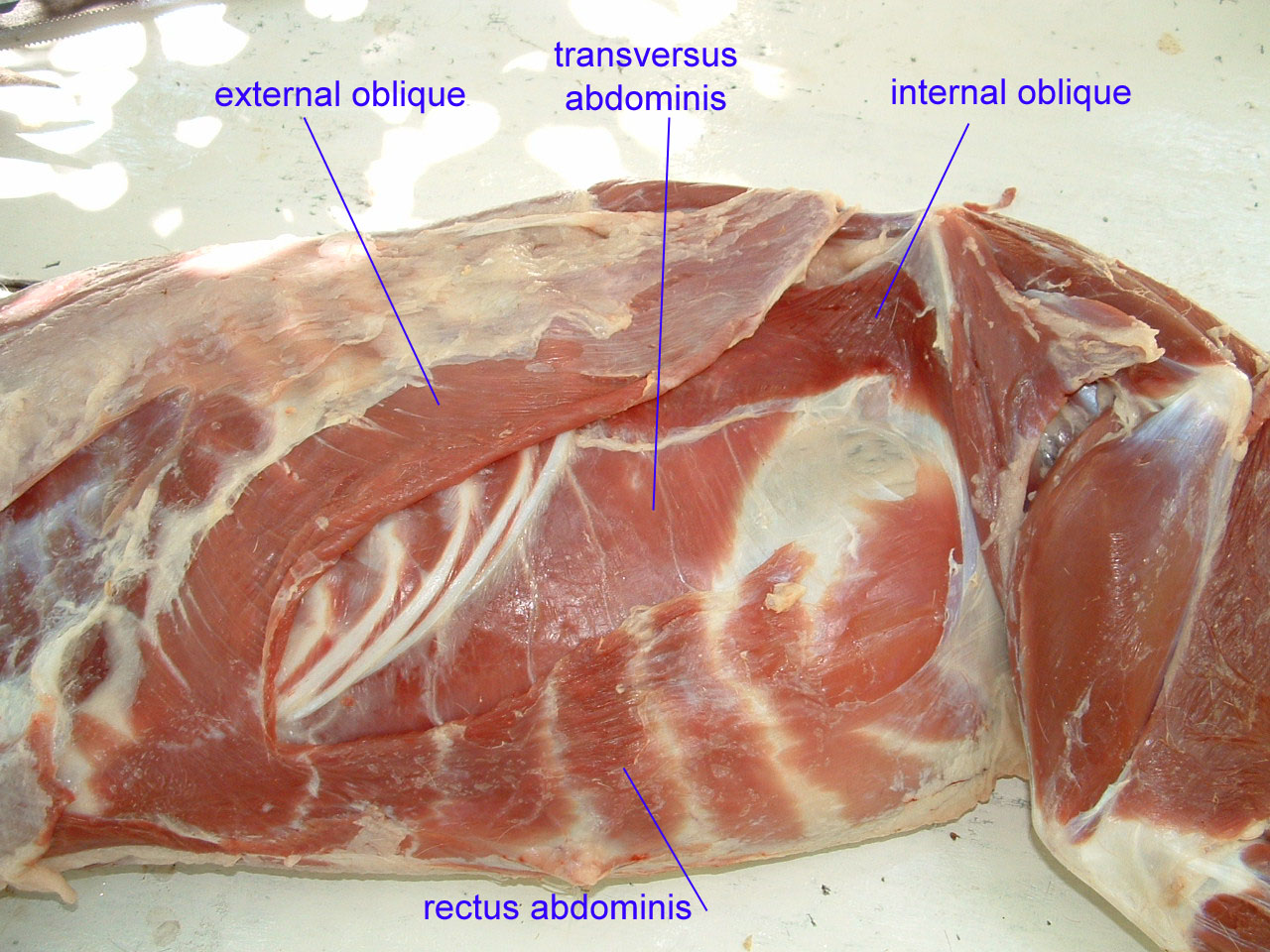 External abdominal Oblique muscle